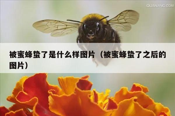 被蜜蜂蛰了是什么样图片（被蜜蜂蛰了之后的图片）