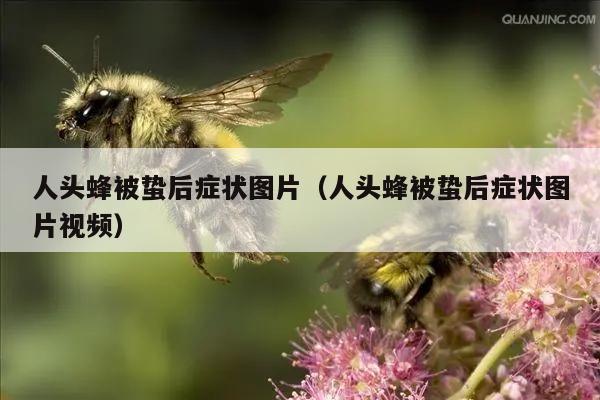 人头蜂被蛰后症状图片（人头蜂被蛰后症状图片视频）